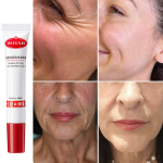 Unleash Youthful Skin with Retinol Wrinkle Remover Cream